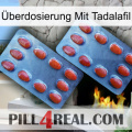 Überdosierung Mit Tadalafil 05